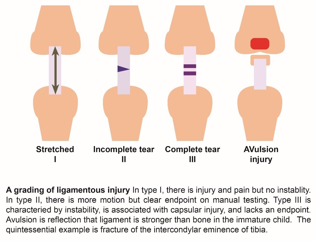 Muscle Tear Grading