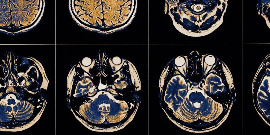 Image of brain scans