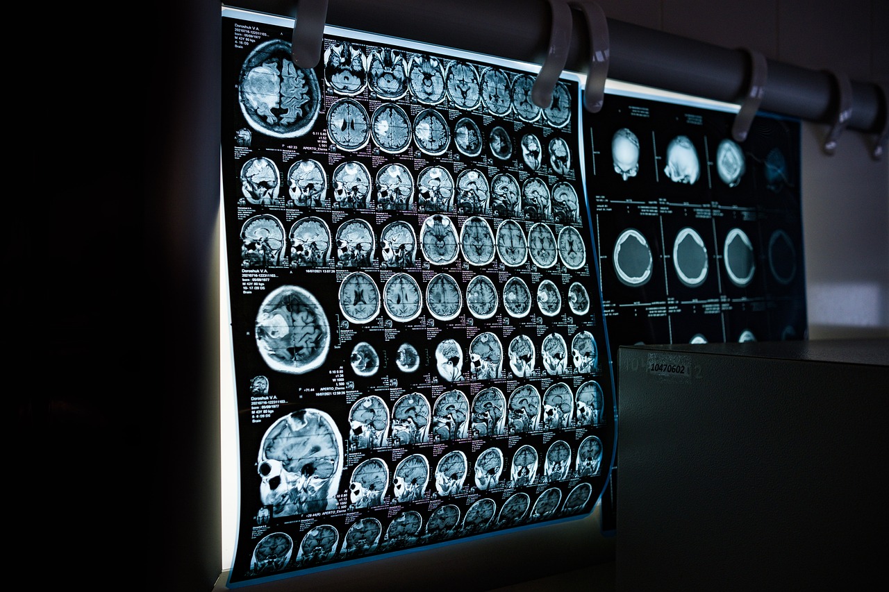 images of brain MRI scans