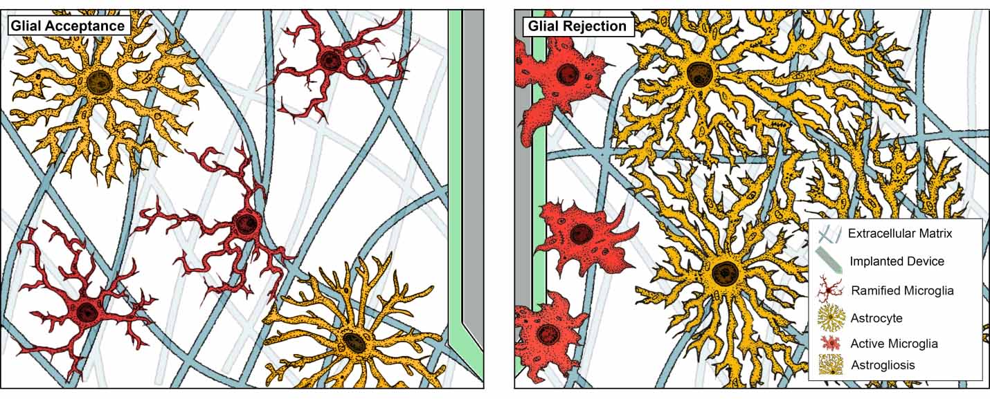 Rejection of implantable device/material in CNS. Shown here is an electrode being targeted by microglia, the resident immune cell, which subsequently recruit astrocytes to generate the glial scar (PMID: 30414483). graphic image of Glial acceptance and rejection
